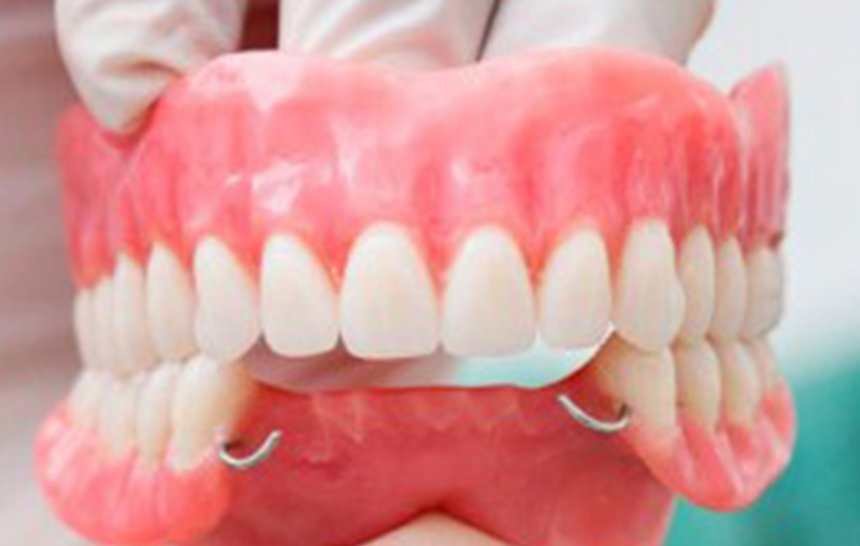 Cómo limpiar prótesis dentales