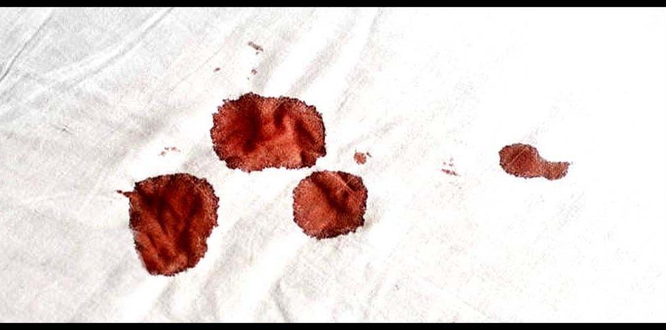Cómo limpiar manchas de sangre