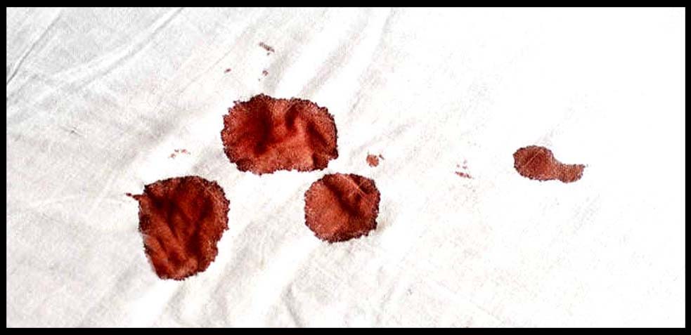 Cómo limpiar manchas de sangre